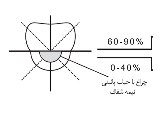 پخش نور نیمه مستقیم